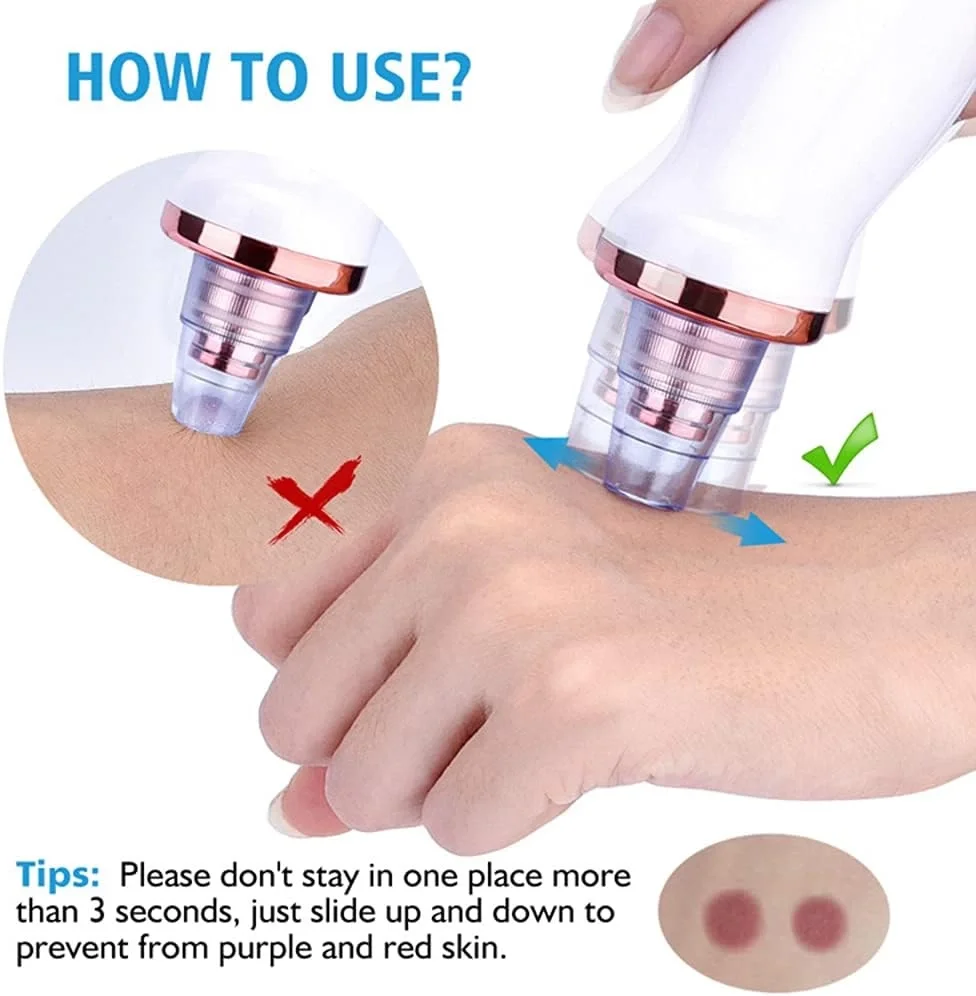 Şarjlı Siyah Nokta Temizleme Cihazı 5 Başlıklı