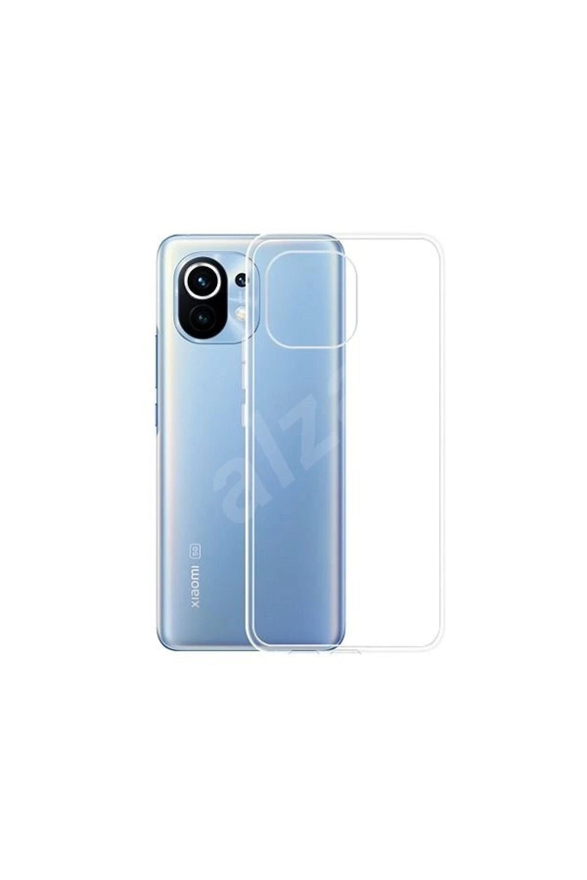 Newface Xiaomi Mi 11 Kılıf Lüx Şeffaf Silikon