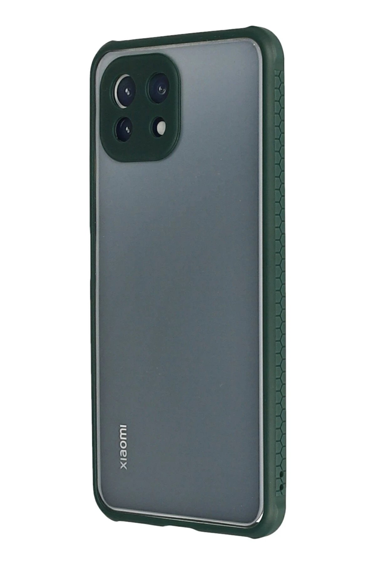 Newface Xiaomi Mİ 11 Lite Kılıf Miami Şeffaf Silikon - Koyu Yeşil