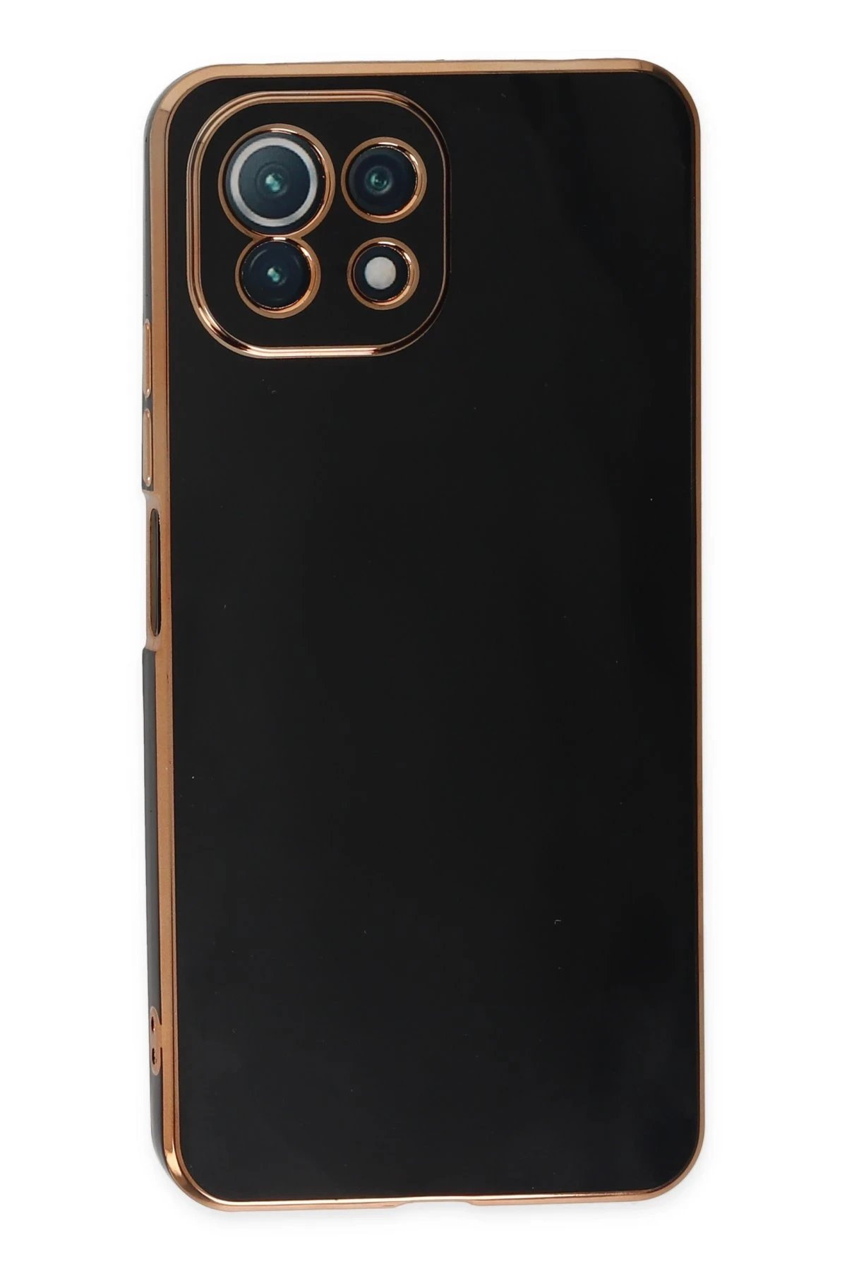 Newface Xiaomi Mİ 11 Lite Kılıf Volet Silikon - Siyah