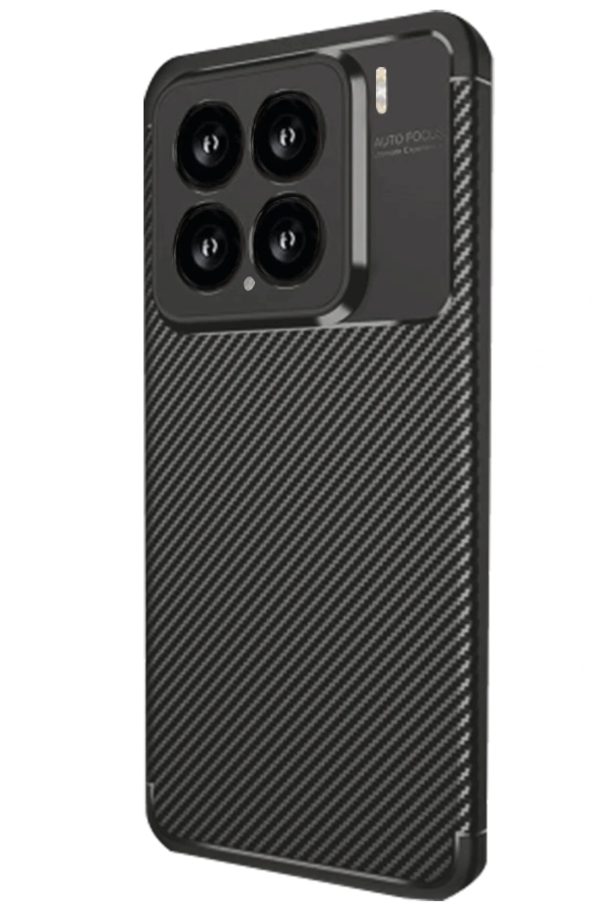 Newface Xiaomi Mi 15 Kılıf Auto Focus Karbon Kapak - Siyah