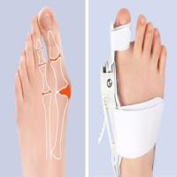 Ayarlanabilir Ayak Baş Parmak Kemik Düzeltici – Halluks Valgus (Bunyon) Aparatı, Gece Gündüz Kullanıma Uygun Ayak Düzeltme Ateli