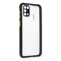 Newface Samsung Galaxy M31 Kılıf Miami Şeffaf Silikon - Lacivert