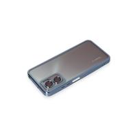 Newface Xiaomi Redmi Note 11E Kılıf Razer Lensli Silikon - Açık Mavi