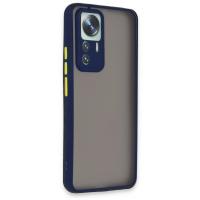 Newface Xiaomi Mi 12T Pro Kılıf Montreal Silikon Kapak - Lacivert