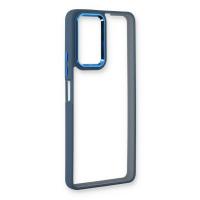 Newface Xiaomi Redmi Note 11 Pro Kılıf Dora Kapak - Mavi