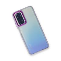 Newface Xiaomi Redmi Note 11 Pro Kılıf Dora Kapak - Lila