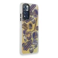 Newface Xiaomi Redmi Note 11 Pro Kılıf Estoril Desenli Kapak - Estoril - 13