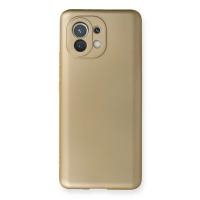 Newface Xiaomi Mi 11 Kılıf First Silikon - Gold