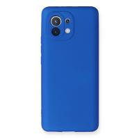 Newface Xiaomi Mi 11 Kılıf First Silikon - Mavi
