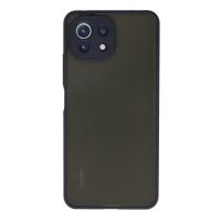 Newface Xiaomi Mİ 11 Lite Kılıf Montreal Silikon Kapak - Lacivert