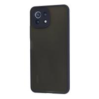 Newface Xiaomi Mİ 11 Lite Kılıf Montreal Silikon Kapak - Lacivert