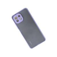 Newface Xiaomi Mİ 11 Lite Kılıf Montreal Silikon Kapak - Mor