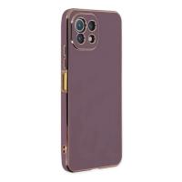 Newface Xiaomi Mİ 11 Lite Kılıf Volet Silikon - Mor