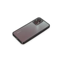 Newface Xiaomi Redmi 10 5G Kılıf Razer Lensli Silikon - Siyah