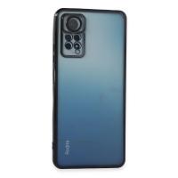 Newface Xiaomi Redmi Note 11 Pro Kılıf Razer Lensli Silikon - Siyah