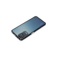 Newface Xiaomi Redmi Note 11 Pro Kılıf Razer Lensli Silikon - Siyah