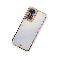 Newface Xiaomi Redmi Note 11 Pro Kılıf Liva Lens Silikon - Rose